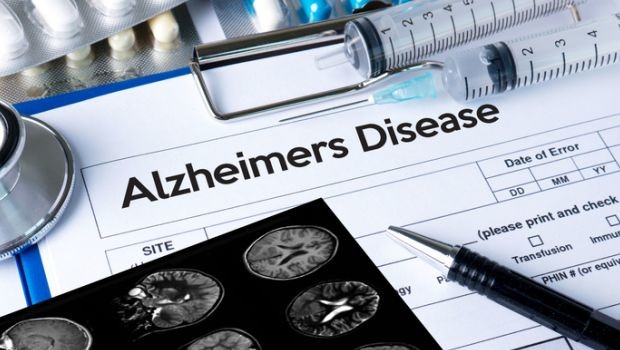 ALZHEIMERS