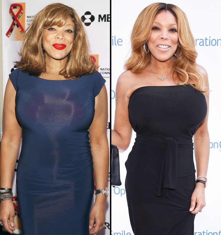 WENDY WILLIAMS NOW AND THEN PHOTOS